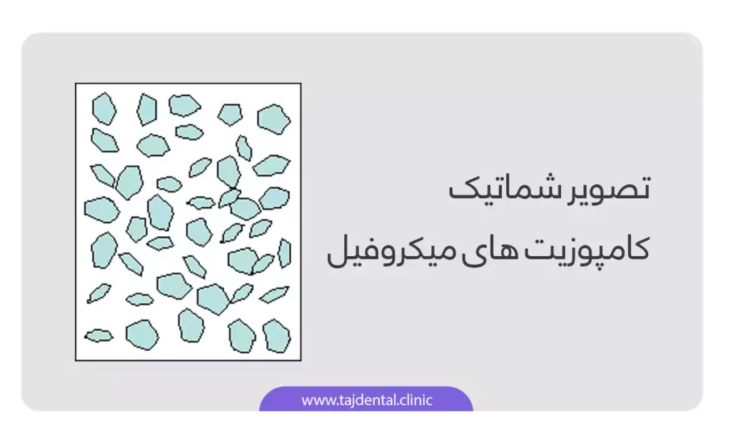 اینفوگرافی کامپوزیت دندان میکروفیل