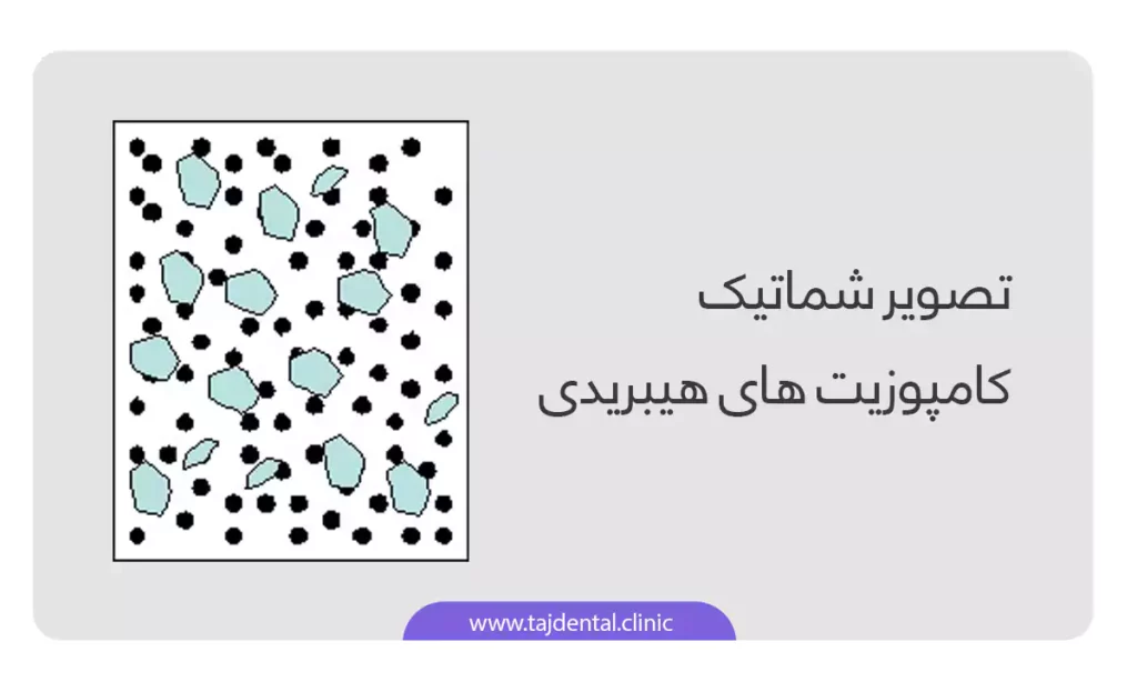 اینفوگرافی کامپوزیت دندان هیبریدی