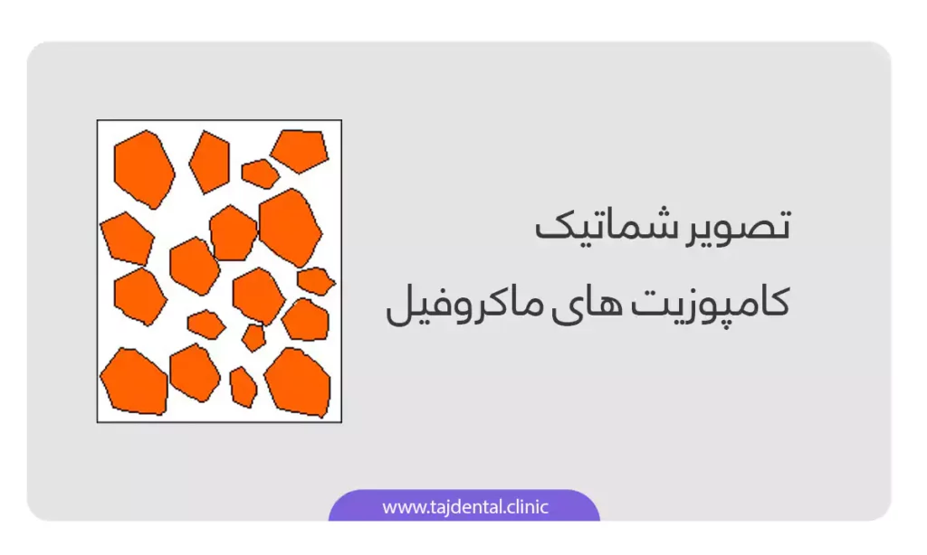 اینفوگرافی ساختار کامپوزیت دندان ماکروفیل