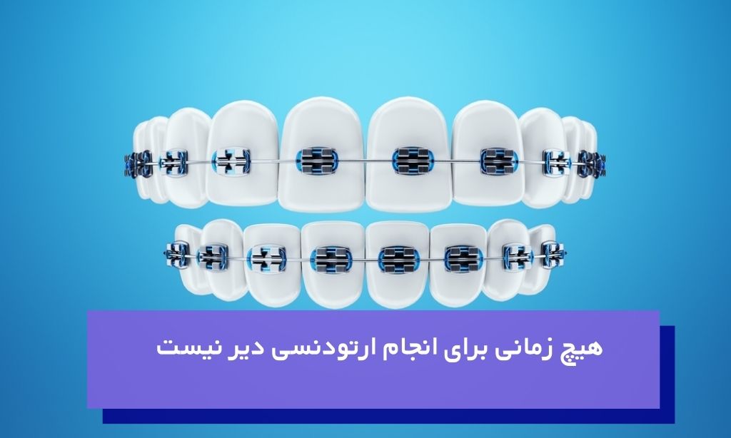 ارتودنسی بزرگسالان