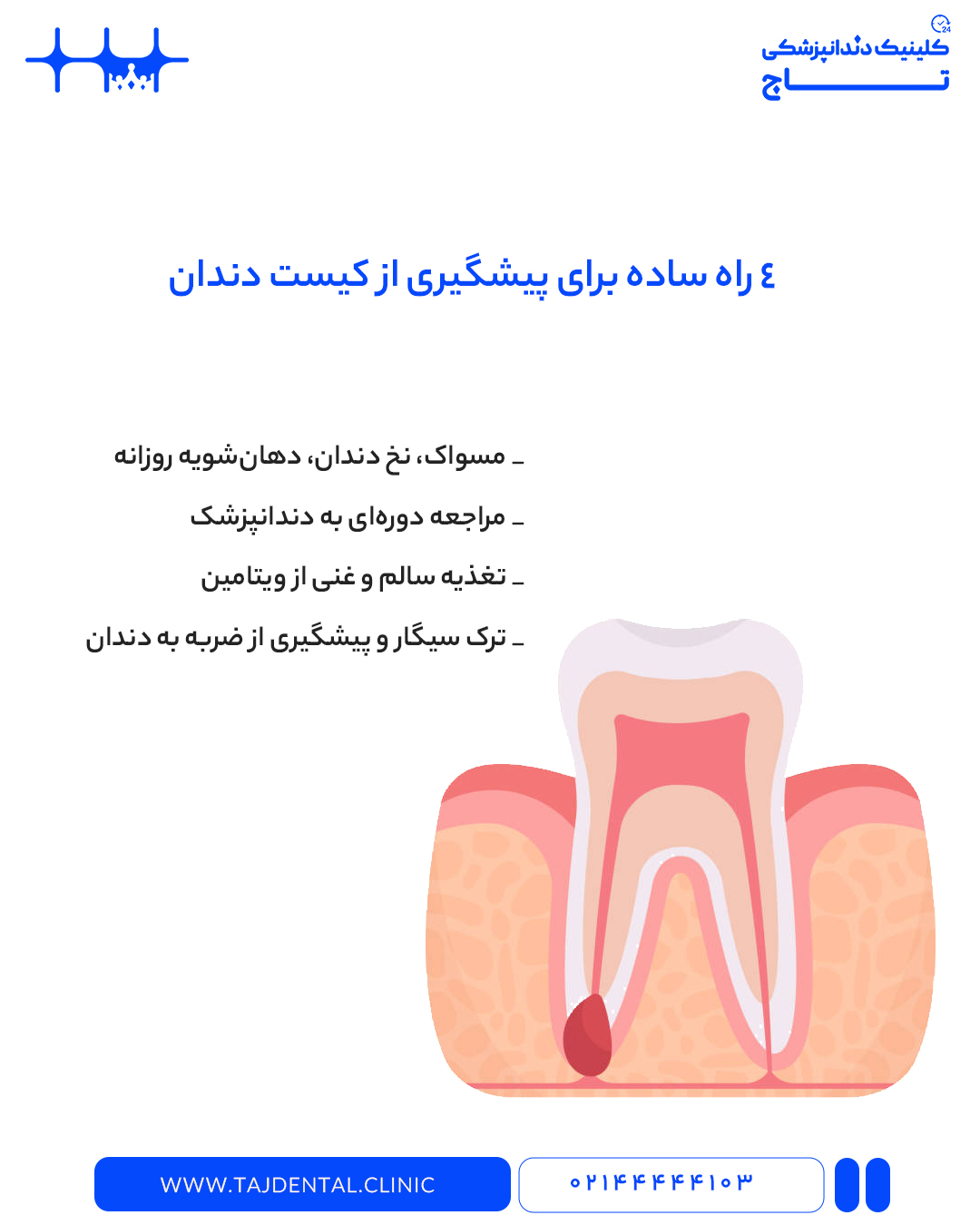 پیشگیری از کیست دندان؛ روش‌های جلوگیری از ایجاد کیست دندانی