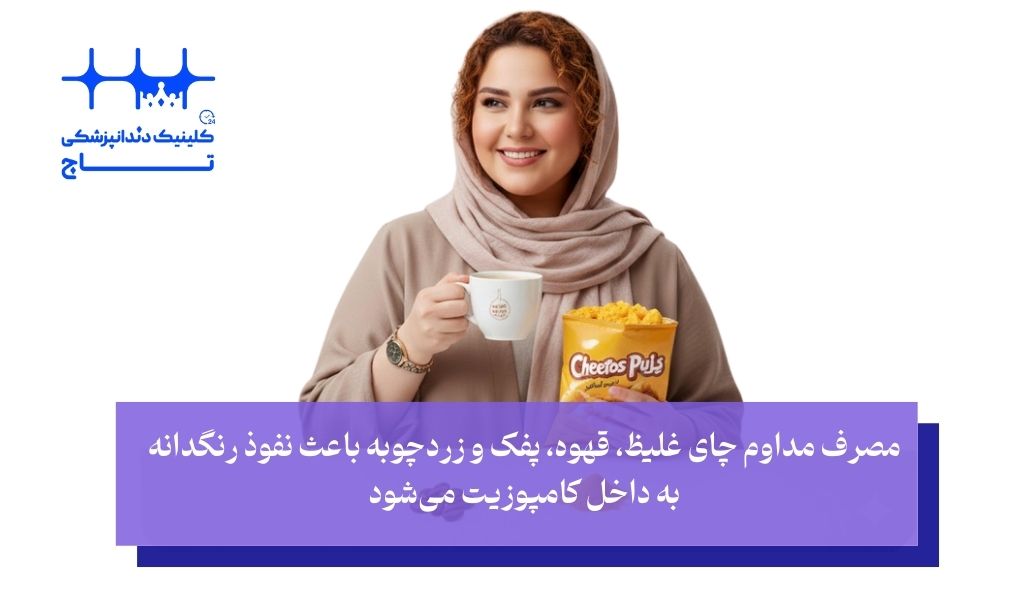 چه عواملی قاتل ماندگاری کامپوزیت دندان هستند