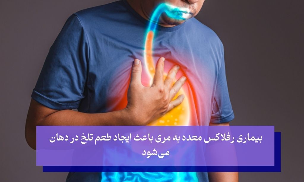 تلخی دهان در صبح و صفرا