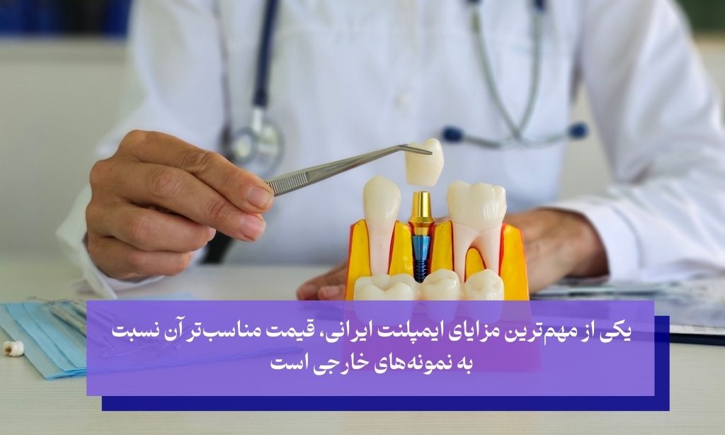 مزایای ایمپلنت ایرانی