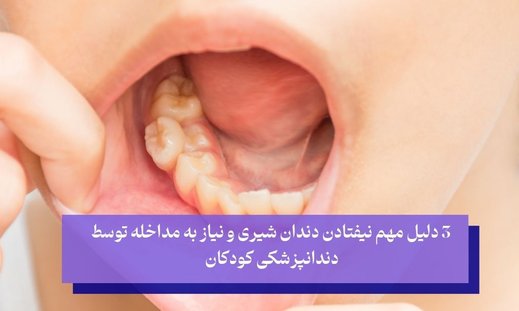 3 دلیل نیفتادن دندان شیری در کودکان