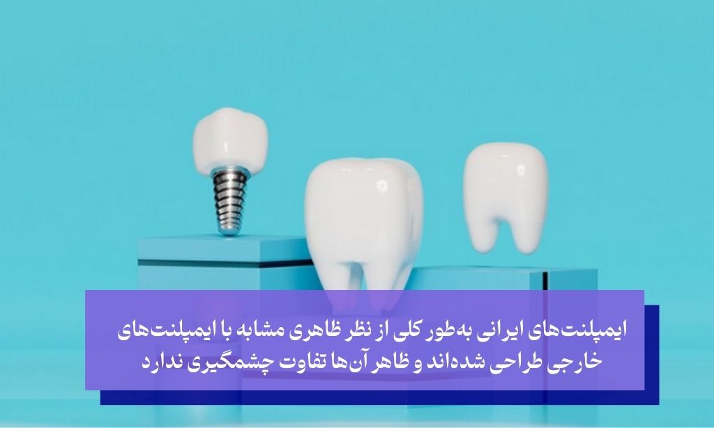 آیا ایمپلنت ایرانی از لحاظ زیبایی هم تفاوتی با برندهای خارجی دارد