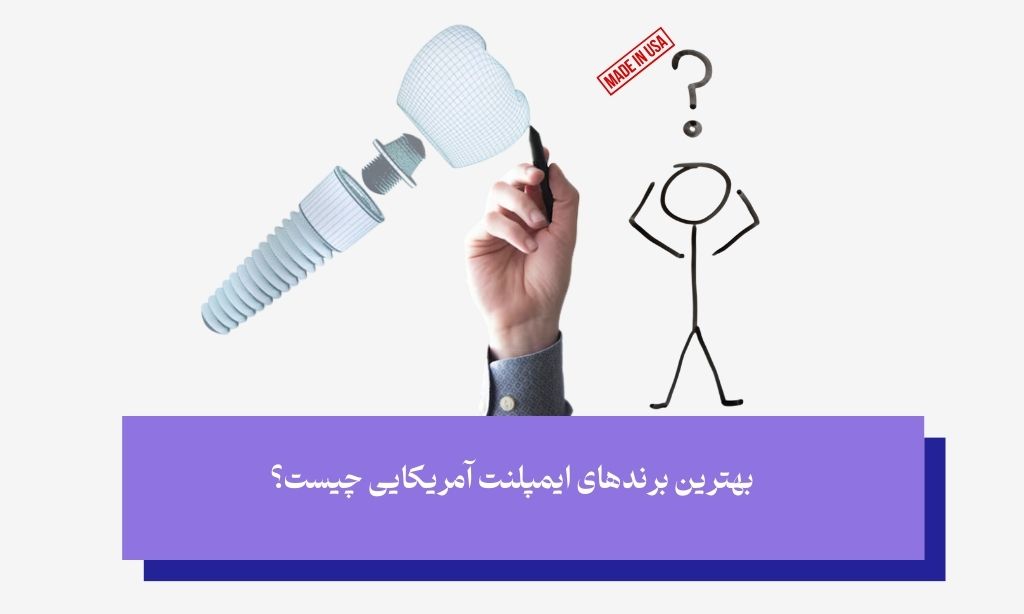 بهترین برندهای ایمپلنت آمریکایی 