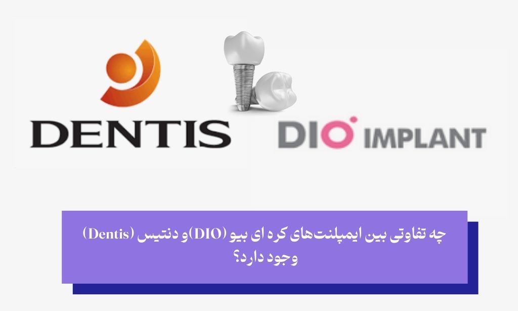 ایمپلنت دیو یا دنتیس