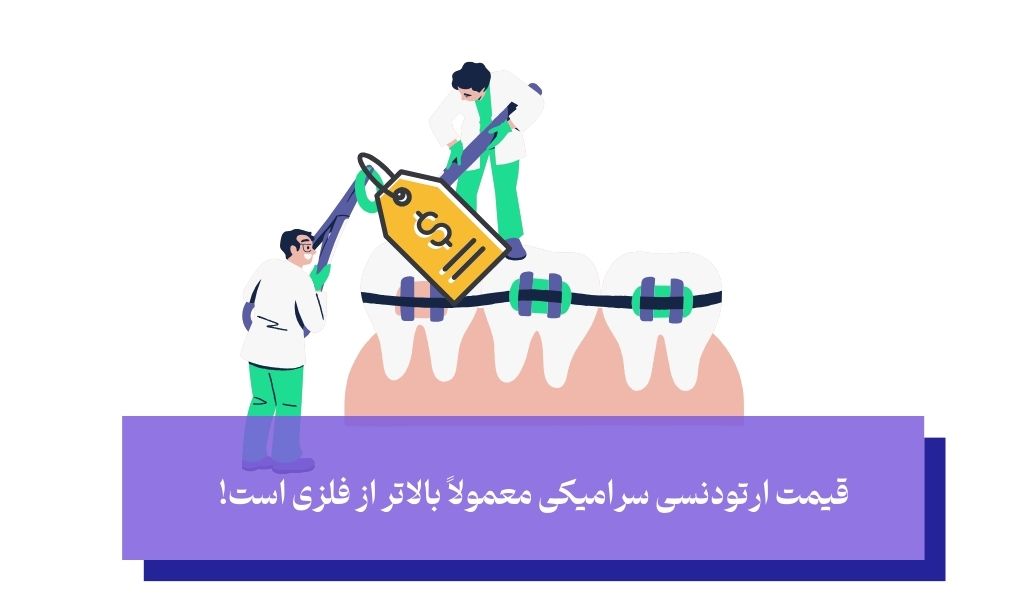 قیمت ارتودنسی سرامیکی