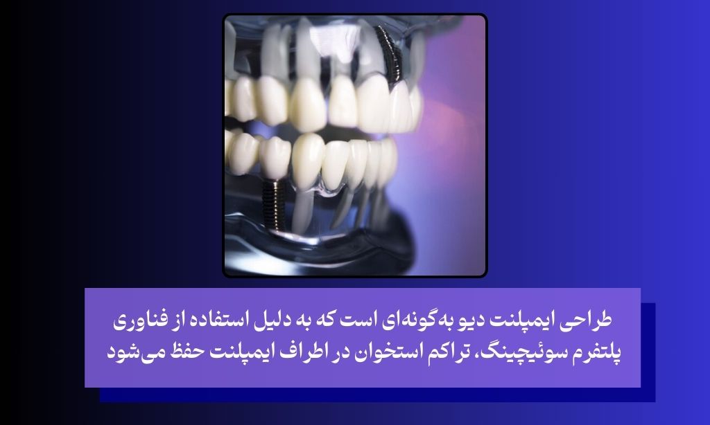 ایمپلنت دیو مناسب چه کسانی است؟