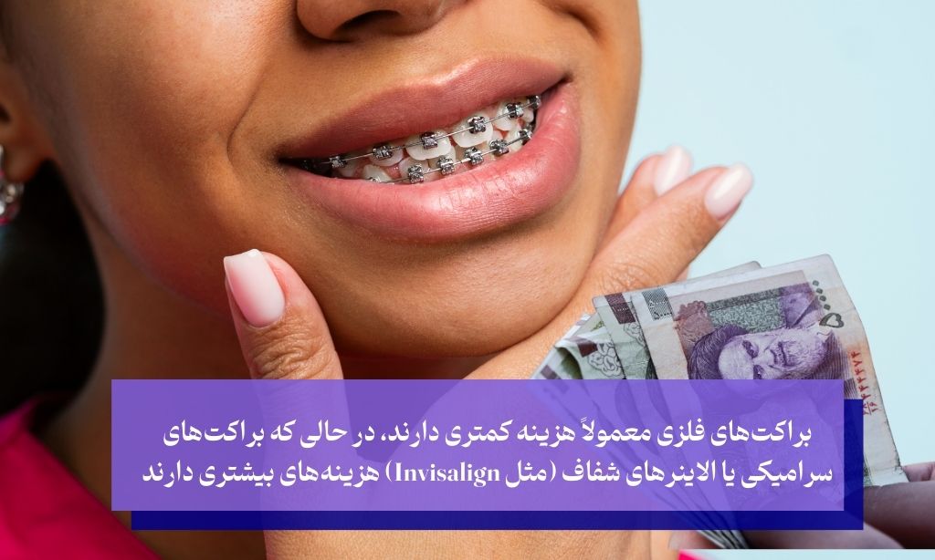 عوامل موثر بر هزینه ارتودنسی