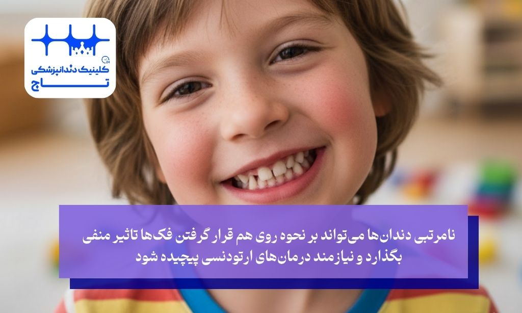 عوارض نیفتادن دندان شیری