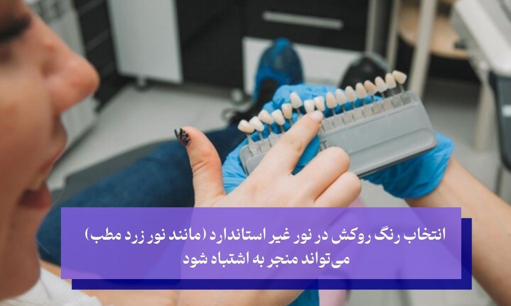 اشتباهات رایج در انتخاب رنگ روکش دندان