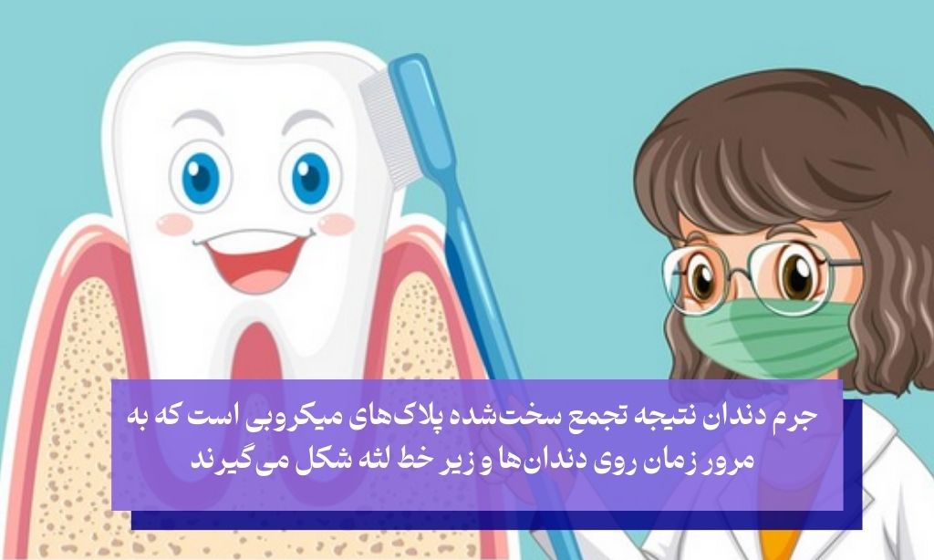 جرم دندان چیست