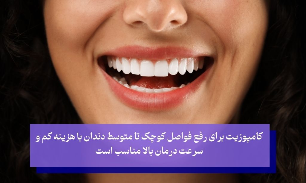 مقایسه کامپوزیت دندان فاصله دار با سایر روش‌های بستن فاصله دندان