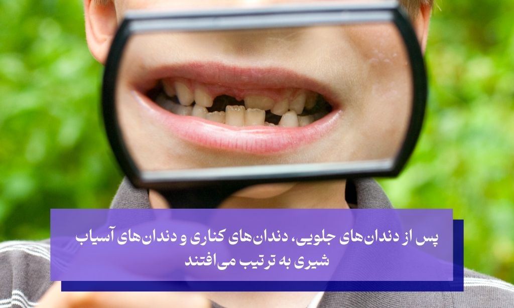ترتیب افتادن دندان شیری کودکان