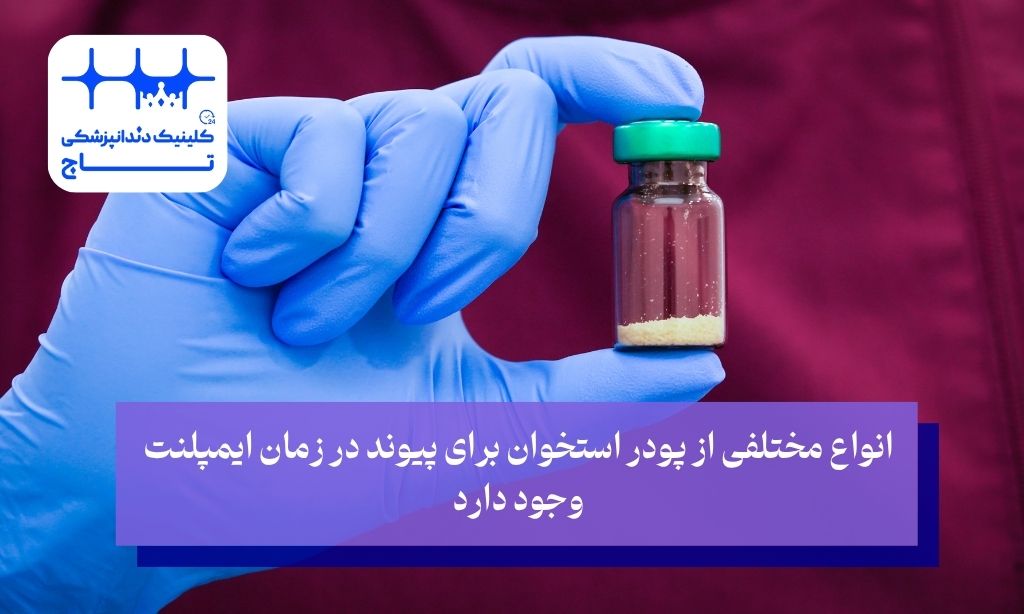 انواع پیوند پودر استخوان برای ایمپلنت