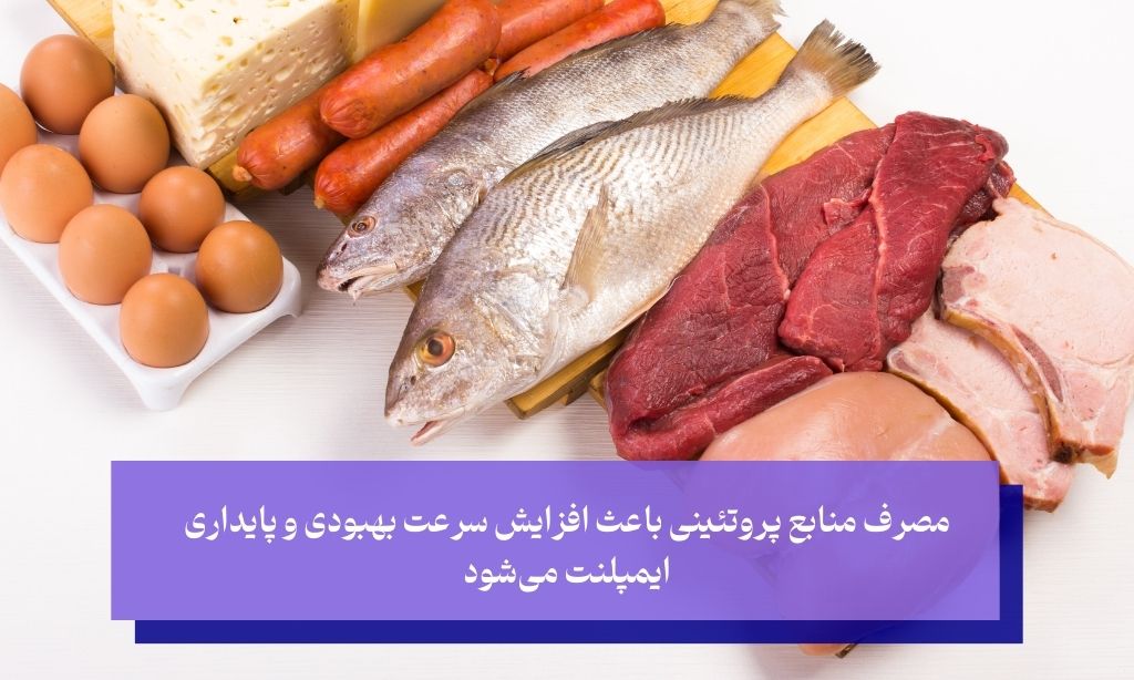 مصرف چه غذاهایی به جوش خوردن سریع‌تر ایمپلنت کمک می‌کنند؟