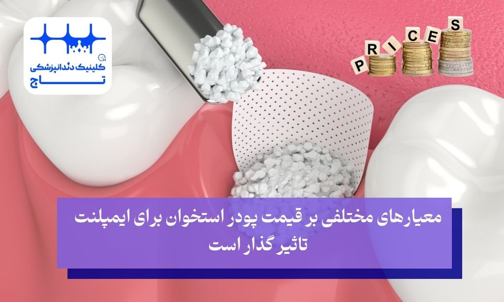 هزینه پیوند استخوان برای ایمپلنت چقدر است