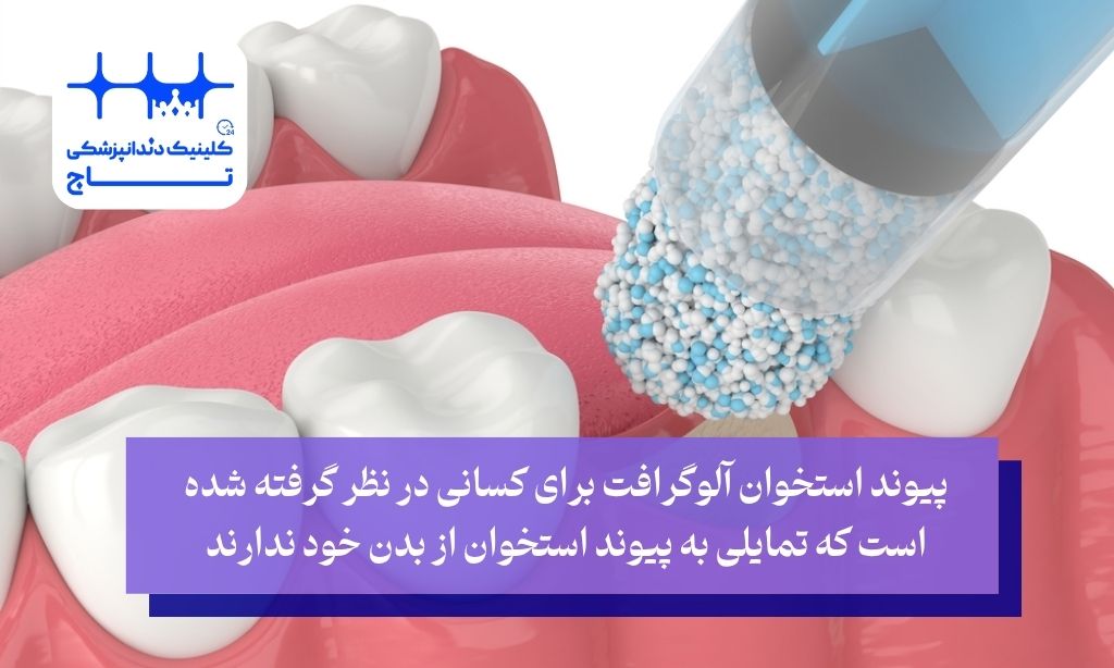 پیوند استخوان آلوگرافت