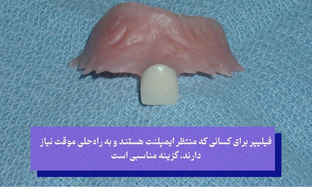 آیا فیلیپر دندان برای همه مناسب است
