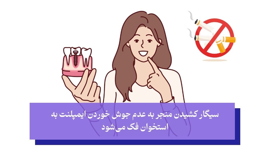 تأثیر سیگار روی جوش خوردن ایمپلنت
