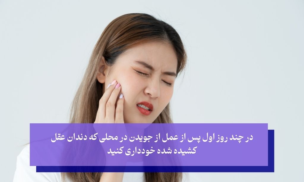 توصیه‌های بعد از کشیدن دندان عقل بدون جراحی