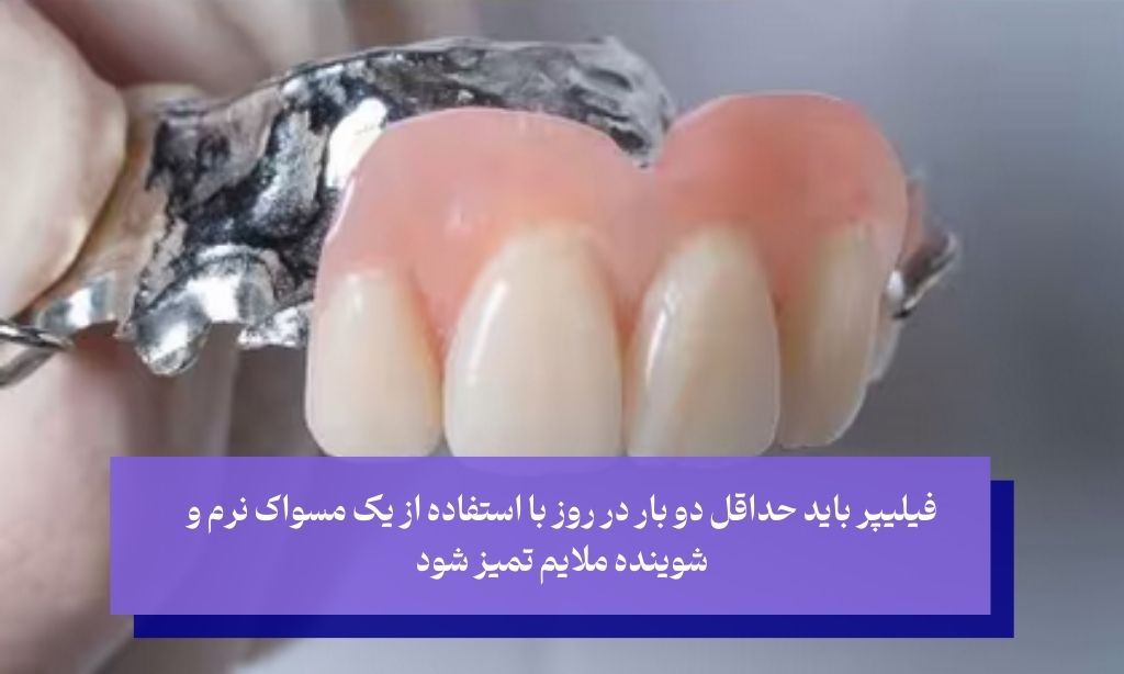 چگونه از فیلیپر دندان مراقبت کنیم
