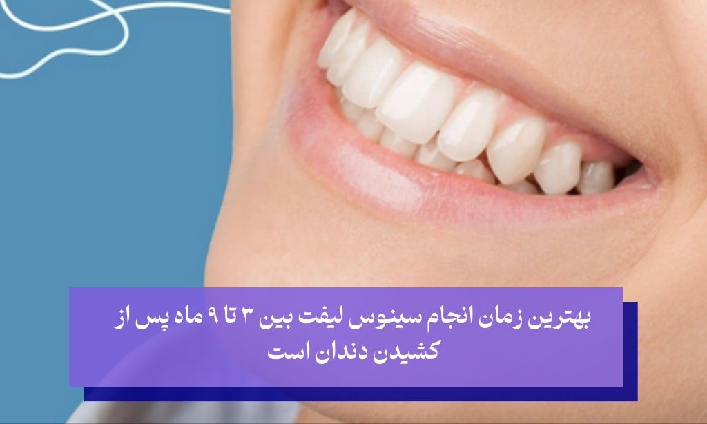 بهترین زمان برای سینوس لیفت
