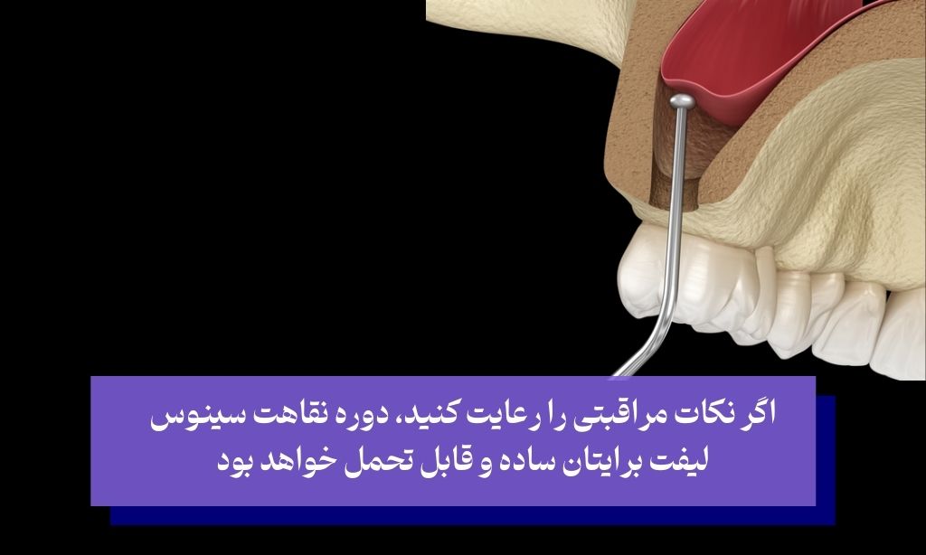 دوران نقاهت پس از سینوس لیفت