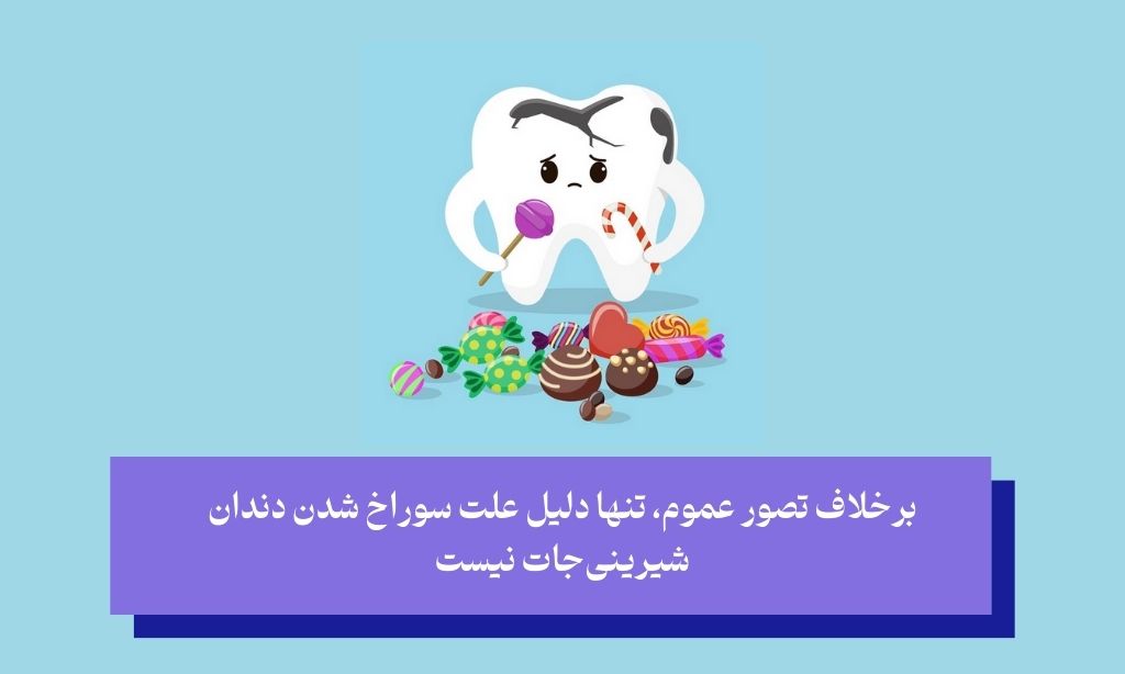 چرا اصلاً حفره دندان ایجاد می‌شود