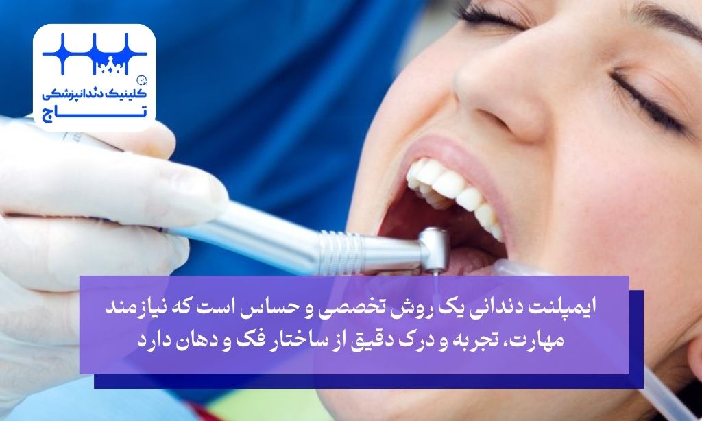 انتخاب بهترین جراح ایمپلنت
