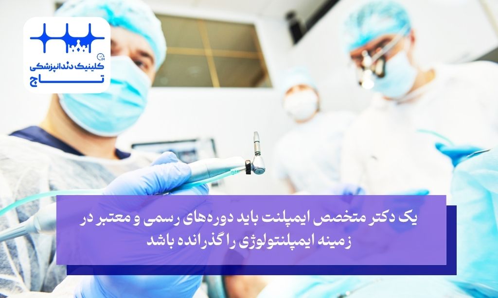 اولین معیار برای انتخاب بهترین متخصص ایمپلنت دندان