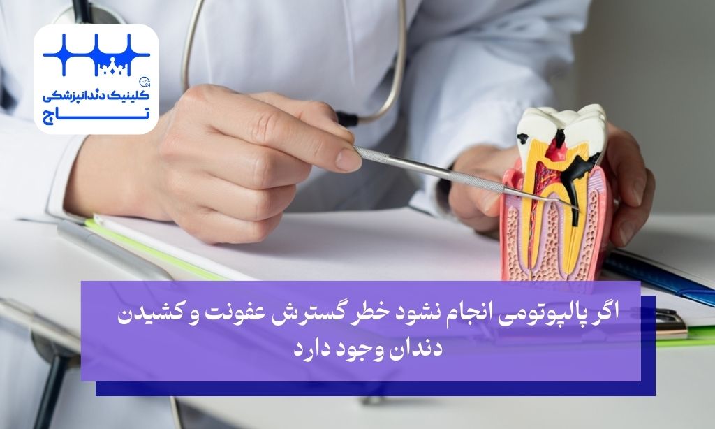 اگر پالپوتومی انجام نشود چه اتفاقی رخ میدهد