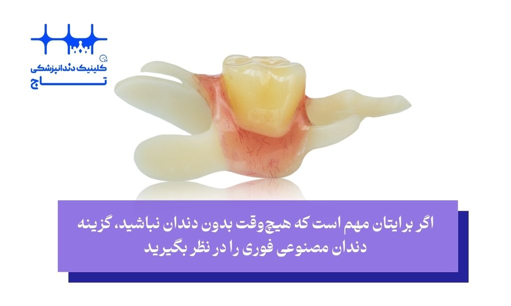 دندان مصنوعی فوری بهتر است یا معمولی