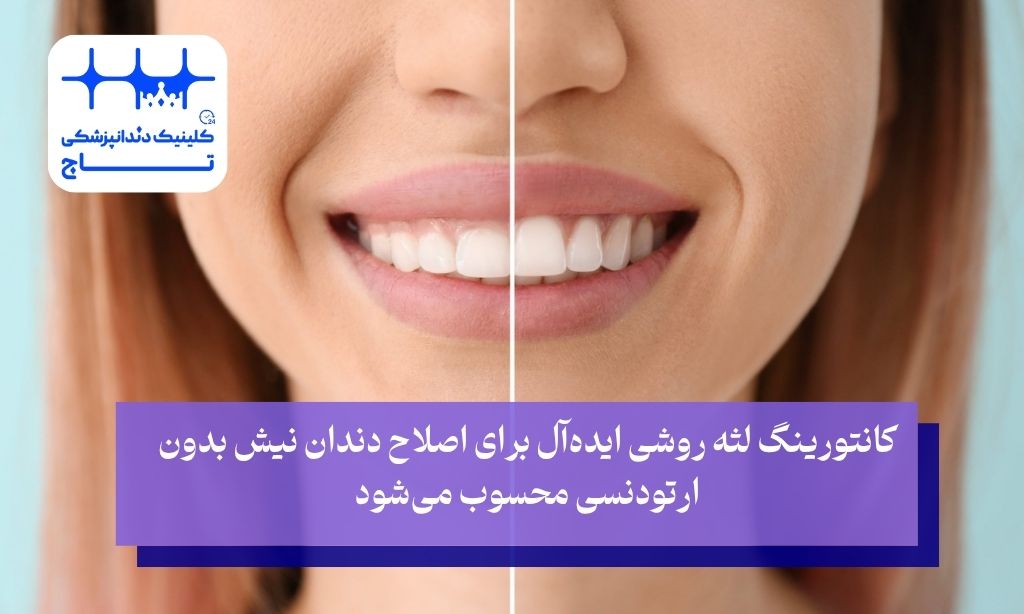 روشهای تهاجمی اصلاح دندان نیش