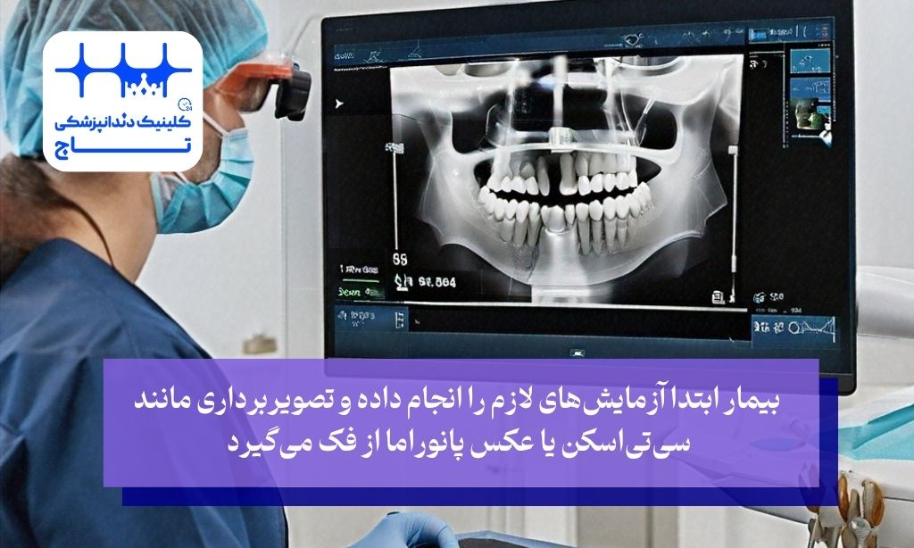 مراحل کاشت ایمپلنت با لیزر