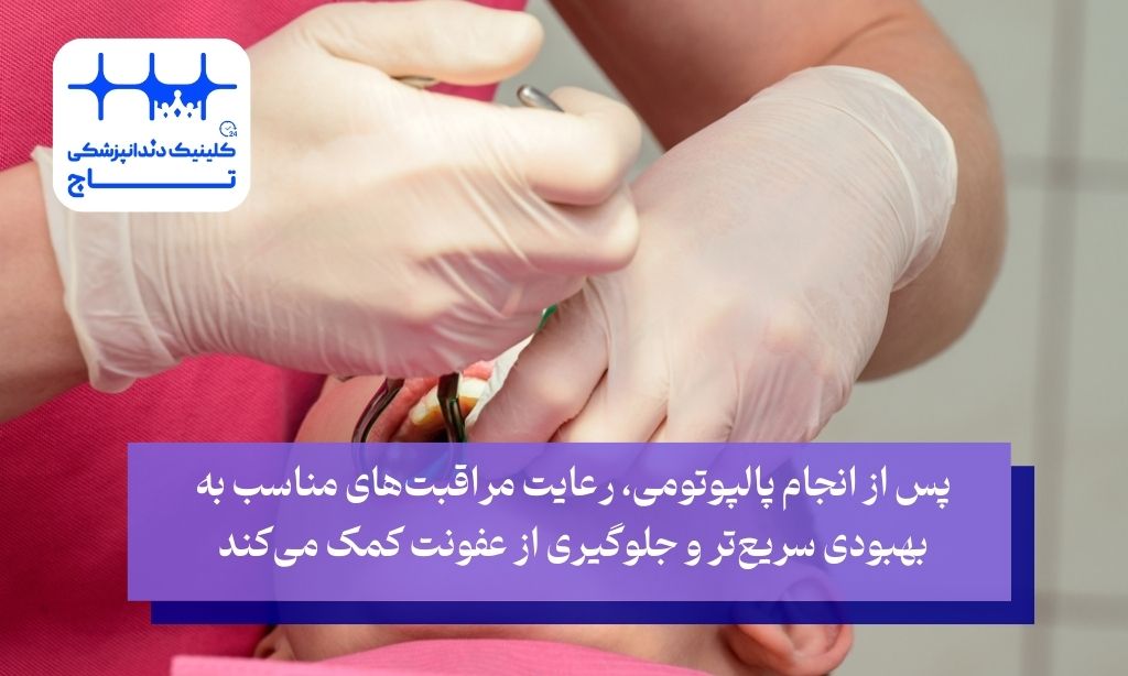 مراقبت پس از پالپوتومی