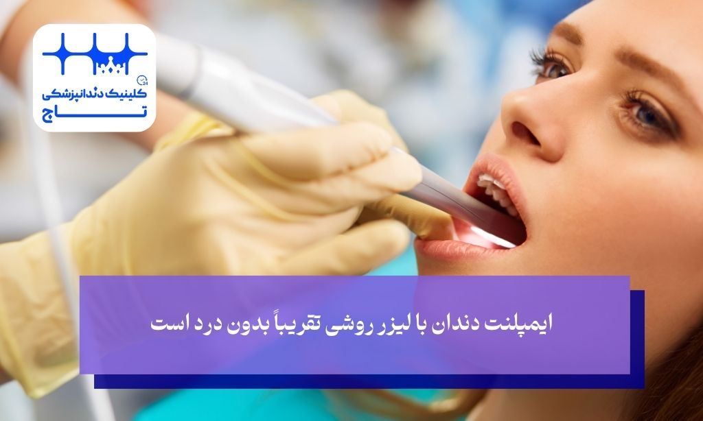 مزایای ایمپلنت دندان با لیزر