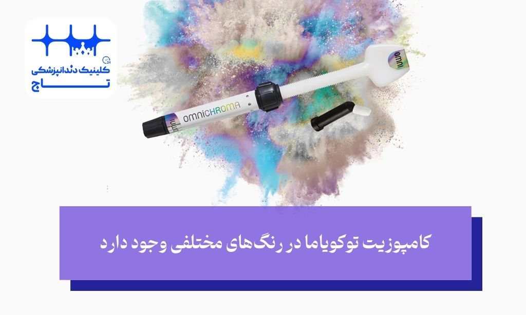 مزایای کامپوزیت توکویاما
