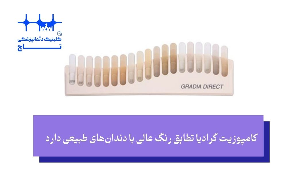 مزایا و معایب کامپوزیت برند گرادیا