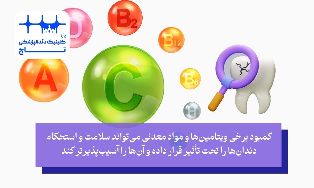 ویتامین و شکستن دندان آسیاب؛ کمبود کدام ویتامینها میتواند به شکستن دندانها دامن بزند