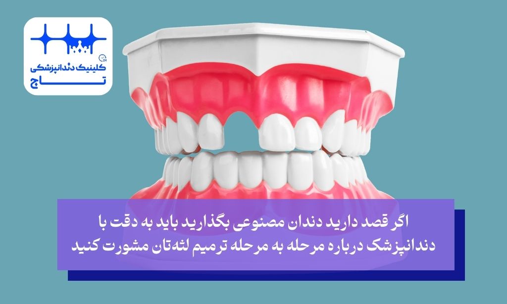چه اتفاقی برای لثه بعد از کشیدن دندان میافتد