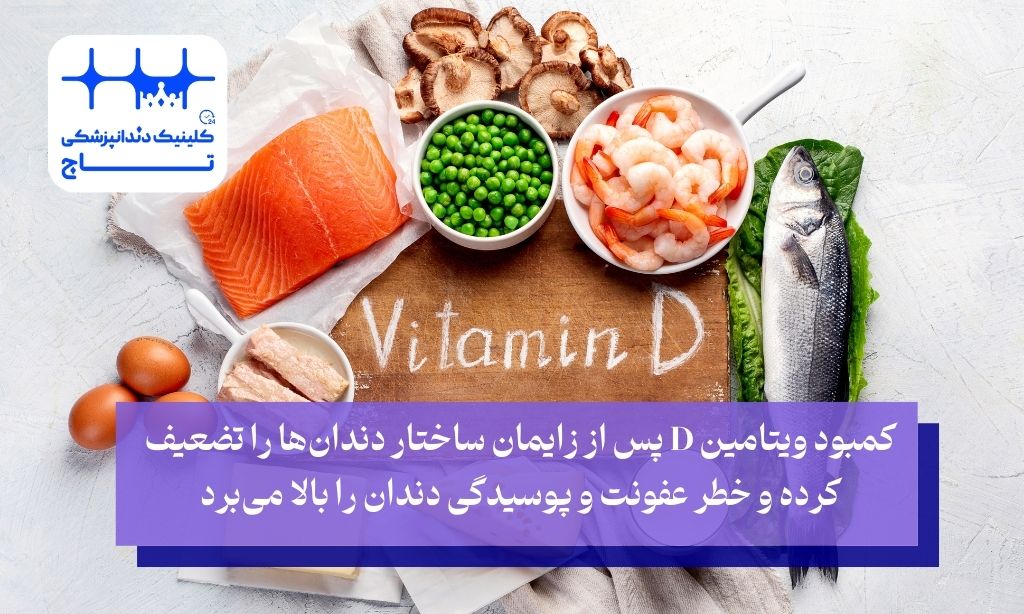 کمبود مواد معدنی پس از زایمان و پوسیدگی دندان