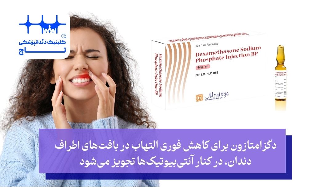 درمان التهاب بافت اطراف دندان