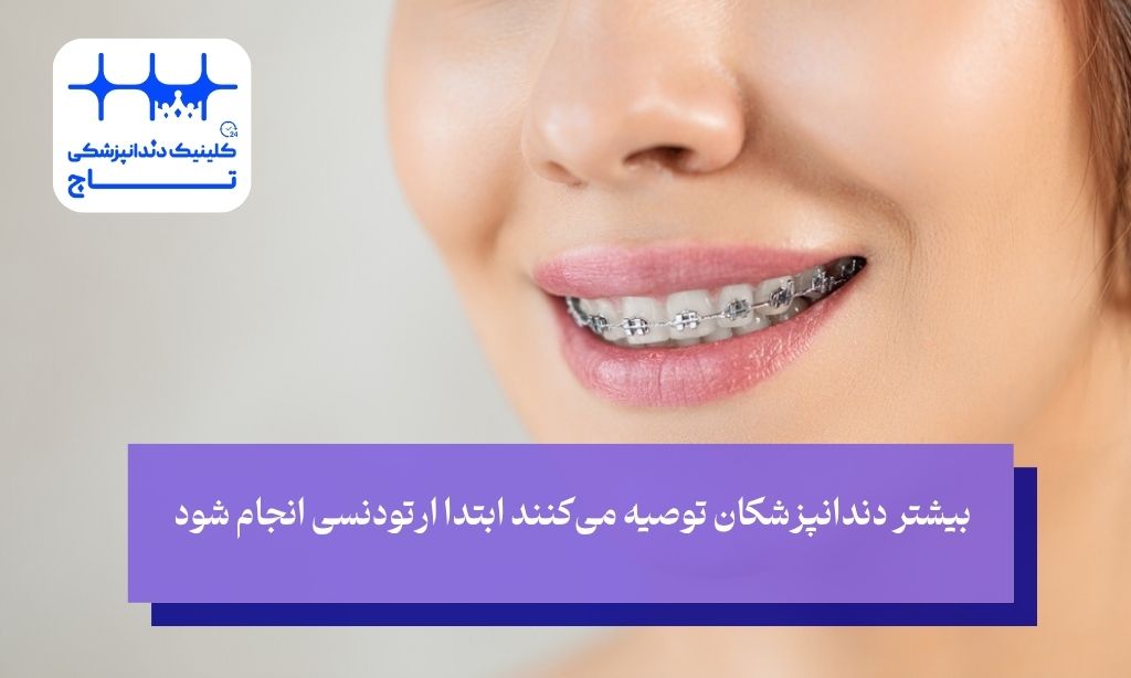 انجام ارتودنسی در ابتدا