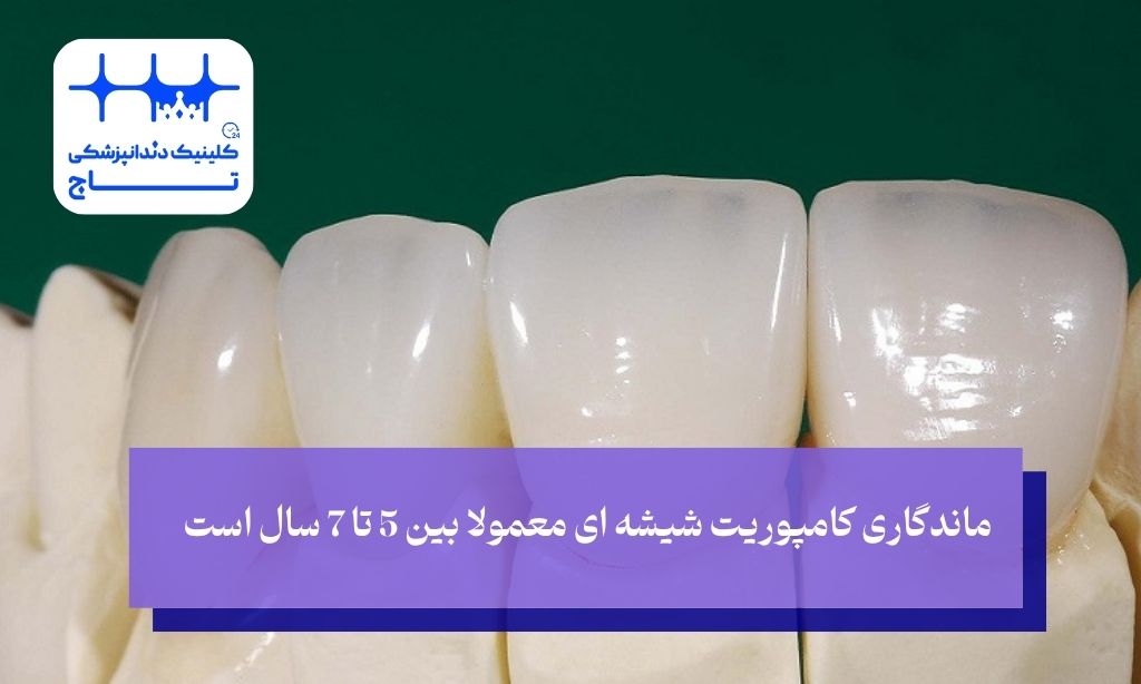 طول عمر کامپوزیت شیشه ای دندان