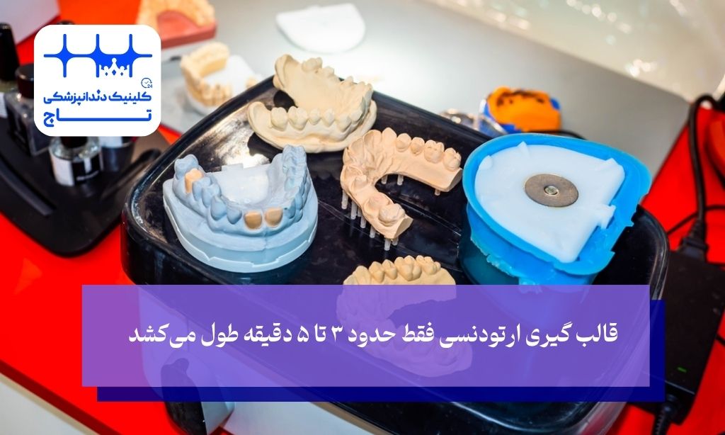 قالب گیری ارتودنسی چقدر طول می کشد