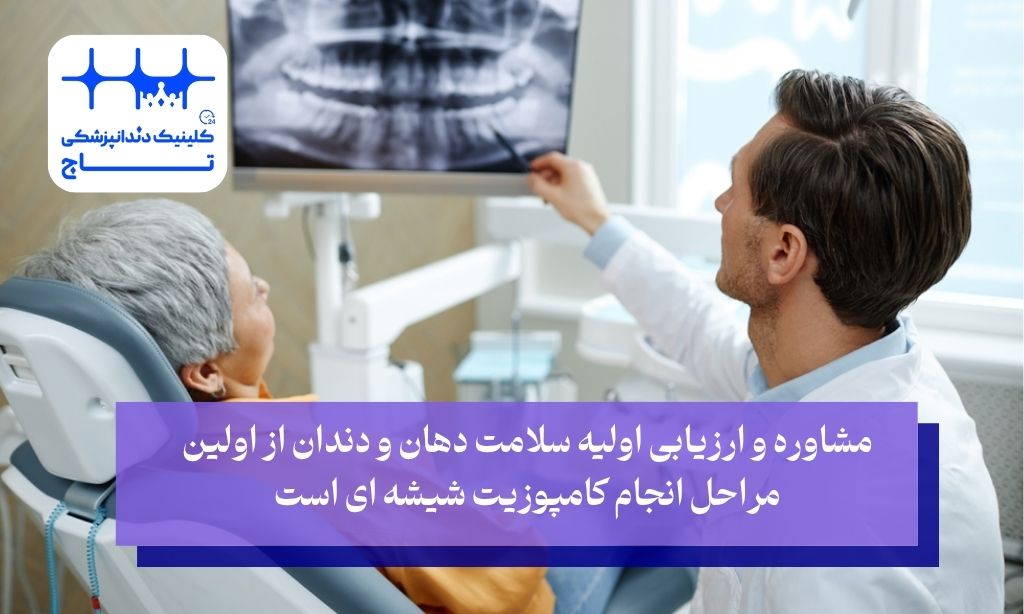 مشاوره و ارزیابی اولیه از مراحل کامپوزیت شیشه ای