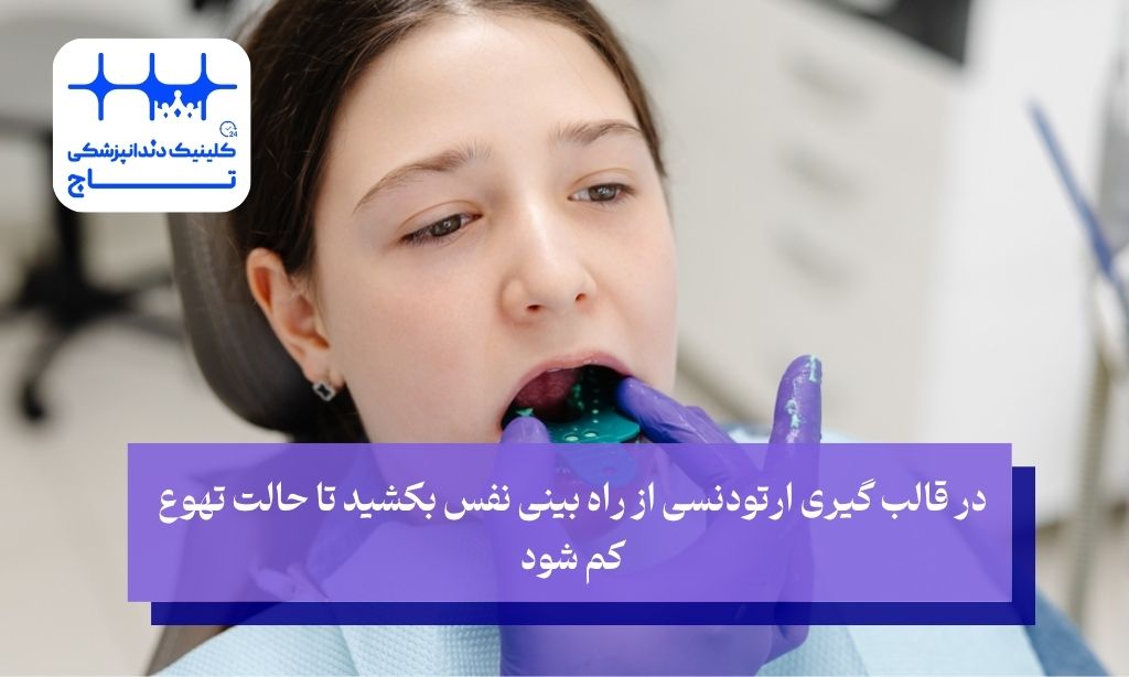 نکات مهم در قالب گیری ارتودنسی